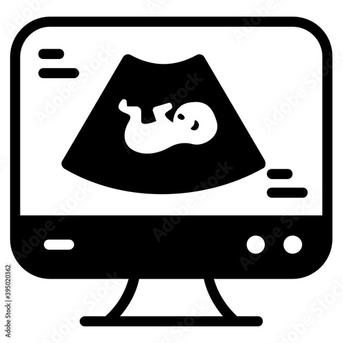 

Filled design of ultrasonography icon, editable vector 
