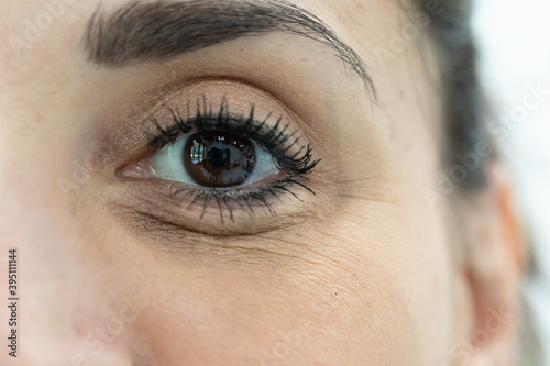 eye bags close up on woman face with dark hair