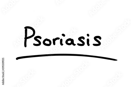 Psoriasis photo