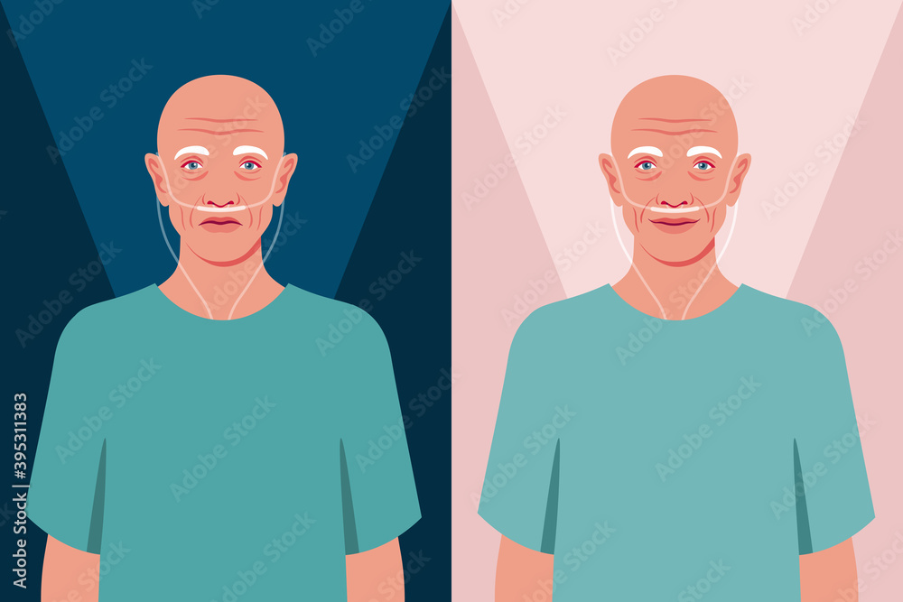 Bald senior man in the hospital. Old cancer patient with a nasal breathing tube. Health care for the elderly people. Coronavirus and respiratory therapy. Vector flat illustration Bald senior man in the hospital. Old cancer patient with a nasal breathing tube. Health care for the elderly people. Coronavirus and respiratory therapy. Vector flat illustration