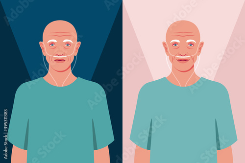 Bald senior man in the hospital. Old cancer patient with a nasal breathing tube. Health care for the elderly people. Coronavirus and respiratory therapy. Vector flat illustration
