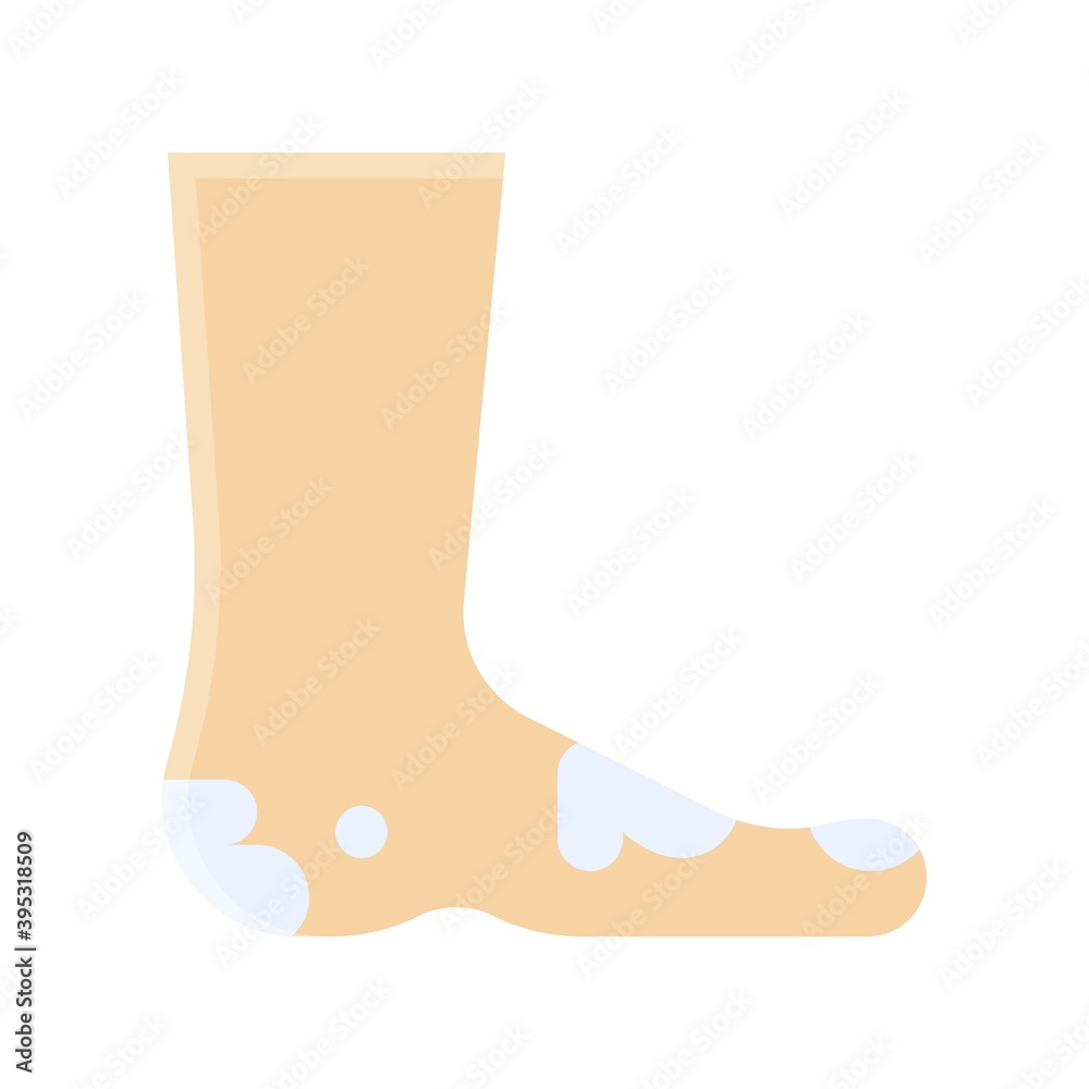 sickness and disease related patient with feet pain problem vectors in flat style,