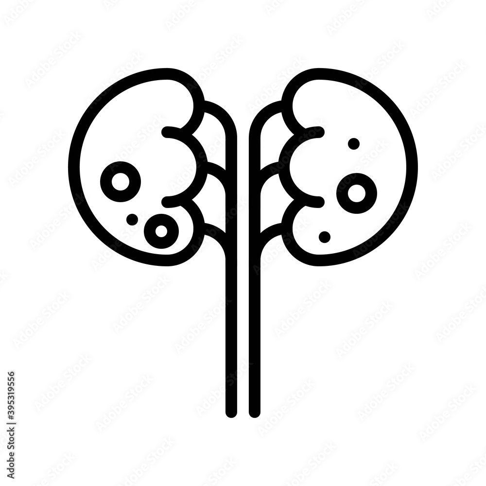 sickness and disease related kidny disease with virus in kidny vectors in lineal style,