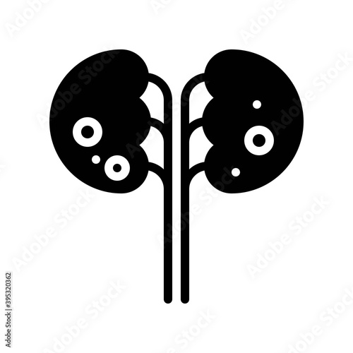 Obraz na płótnie sickness and disease related kidny disease with virus in kidny vectors in solid design, w salonie