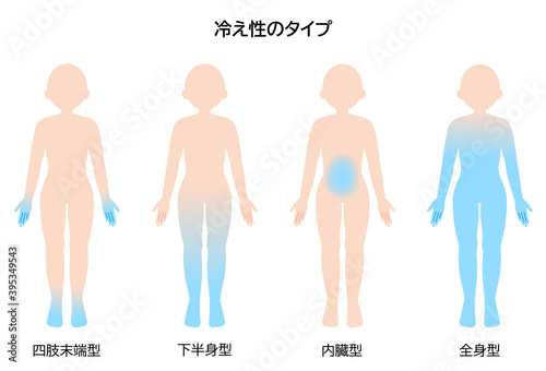 冷え性のタイプ 女性 