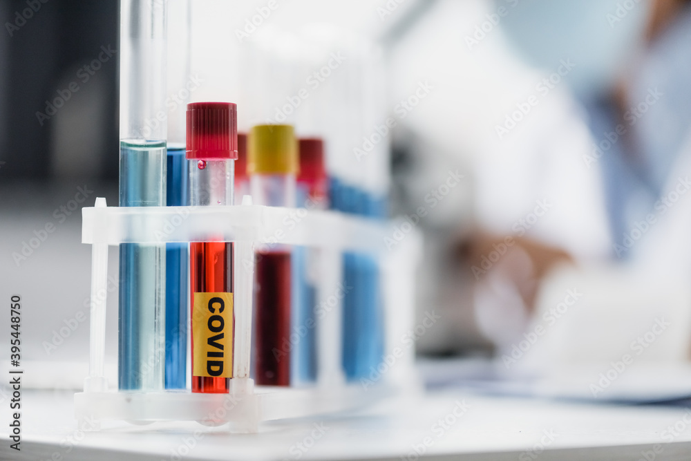close up of glass test tubes with covid lettering and samples with blurred close up of glass test tubes with covid lettering and samples with blurred