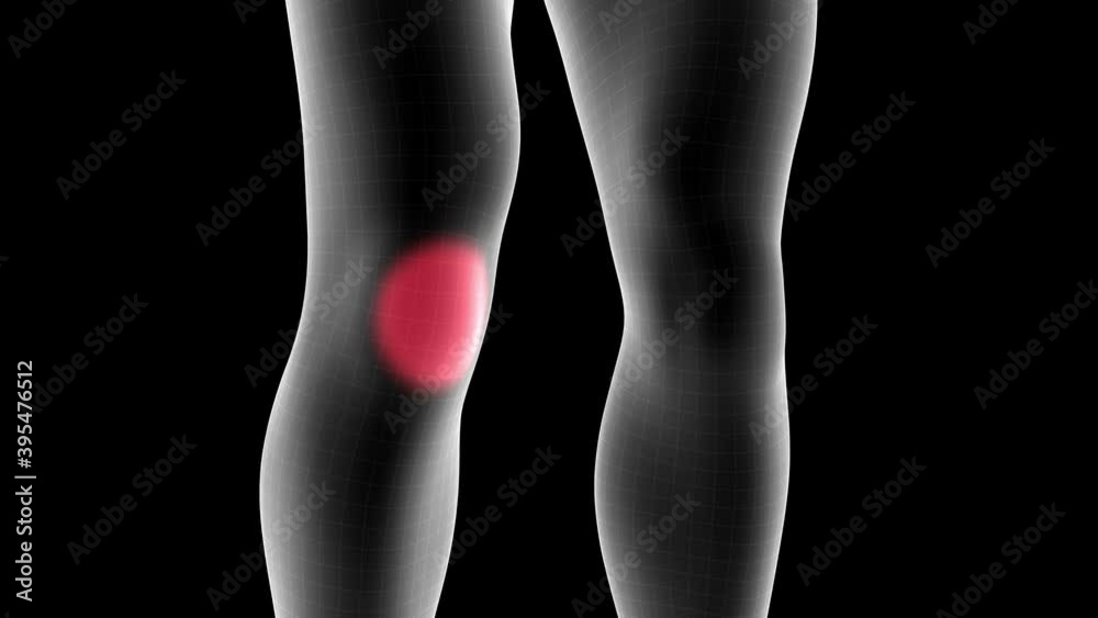 3d animation of a men xray hologram showing pain area on the leg knee front area with alpha channel 3d animation of a men xray hologram showing pain area on the leg knee front area with alpha channel