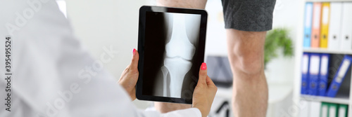Fotografi Traumatologist is holding tablet near patient's sore leg in the clinic closeup