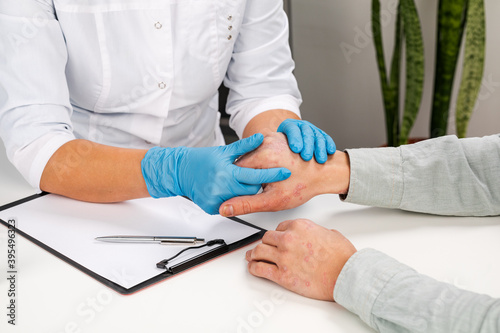 A dermatologist wearing gloves examines the skin of a sick patient. Examination and diagnosis of skin diseases-allergies, psoriasis, eczema, dermatitis