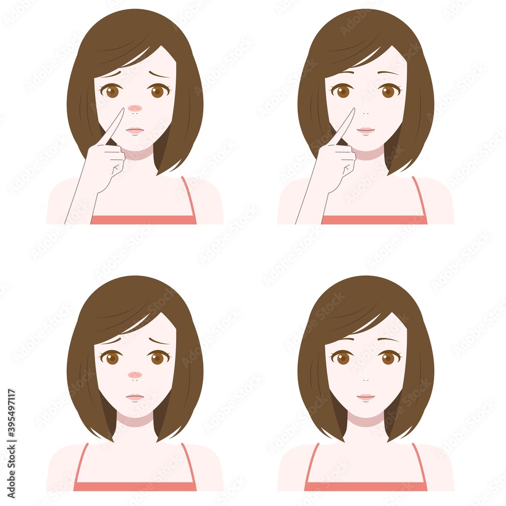 鼻 毛穴 女性 鼻 毛穴 女性