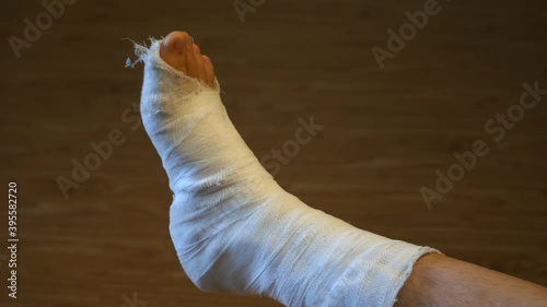 male leg in a plaster cast. toes moving. Plain background, close-up.