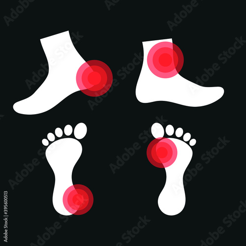 Vector image. Icon of a foot with localized pain.