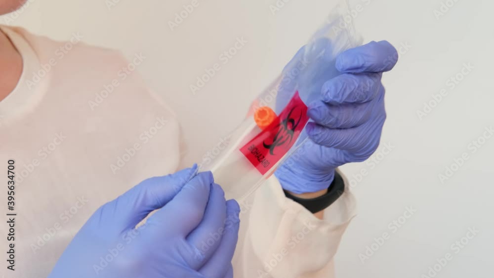 girl holds a kit for a dna test in a box, a cotton swab for scraping