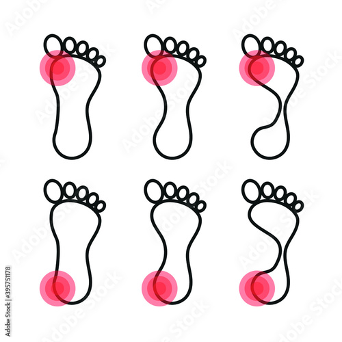 Vector image. Icon of a foot with localized pain.