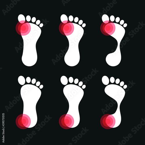 Vector image. Icon of a foot with localized pain.