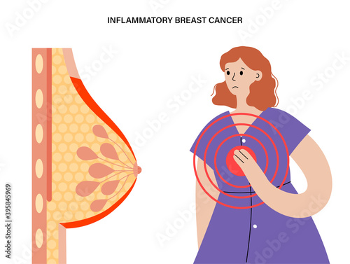 Breast disease concept