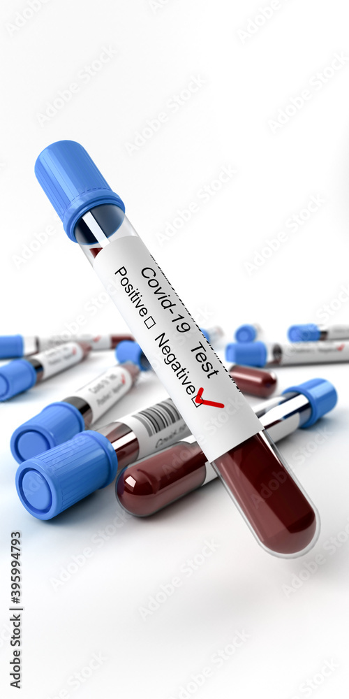 SARS ncov covid 19 blood test tubes, lab test kit