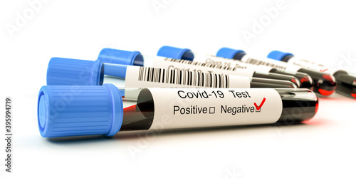 SARS ncov covid 19 blood test tubes, lab test kit