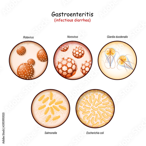 Infectious diarrhea. Close-up of pathogens of intestinal infections: