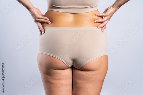 Overweight woman with fat hips and buttocks, obesity female body on gray background © staras