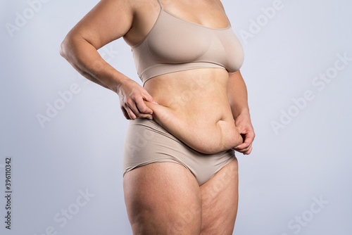 Fototapeta Tummy tuck, flabby skin on a fat belly, plastic surgery concept