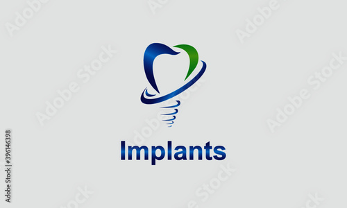 Implants Logo Design Template-Dental Logo Design.