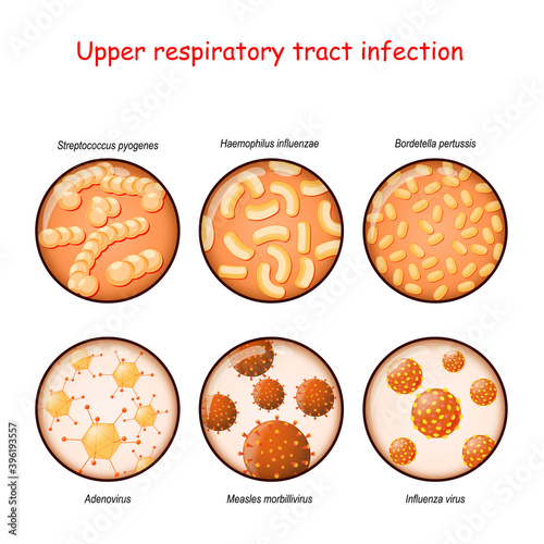 respiratory infection. Bacteria and viruses photo