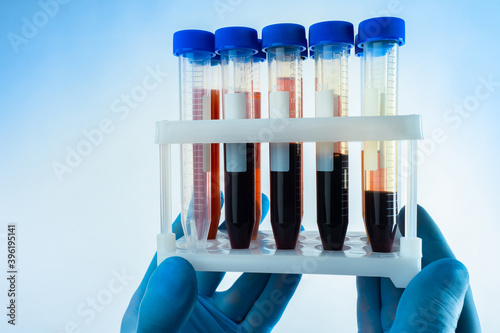 Tableau sur toile Blood tests