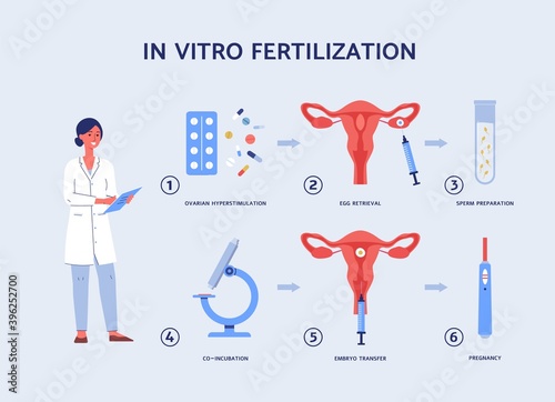 Vector flat illustration of steps ivf with pictures