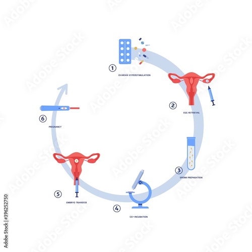 Process of artificial fertilization, flat vector illustration isolated.