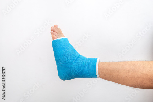 Man's leg in plaster cast and blue splint close up on white background.