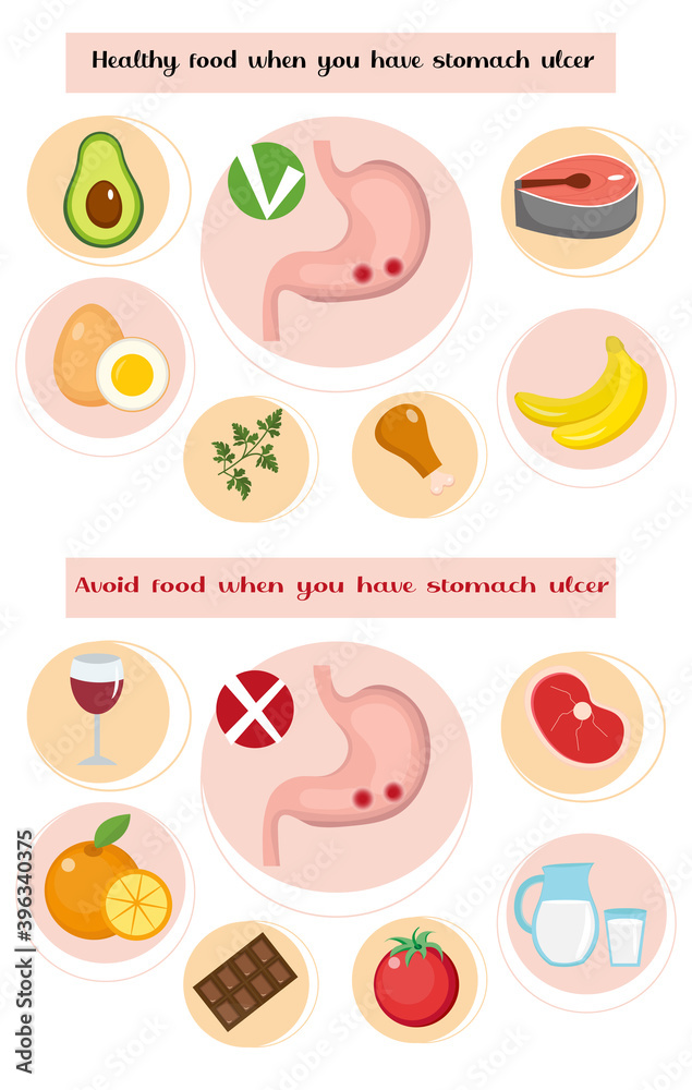Healthy and avoid food if you have stomach ulcer infographics. Prevention of stomach diseases. Medicine concept. Vector illustration Healthy and avoid food if you have stomach ulcer infographics. Prevention of stomach diseases. Medicine concept. Vector illustration