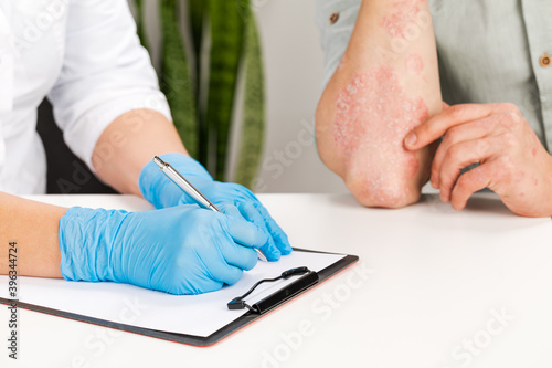 Fototapeta Naklejka Na Ścianę i Meble -  A gloved dermatologist examines the skin of a sick patient and records observations. Examination and diagnosis of skin diseases-allergies, psoriasis, eczema, dermatitis