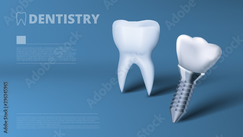 Healthy Tooth And Dental Implant Clinic Ad