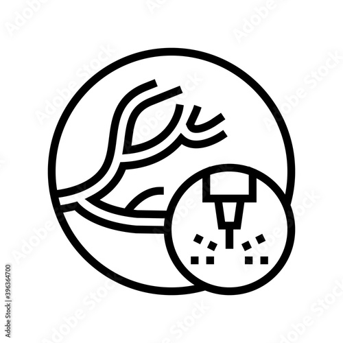 removal of vascular pathologies line icon vector. removal of vascular pathologies sign. isolated contour symbol black illustration