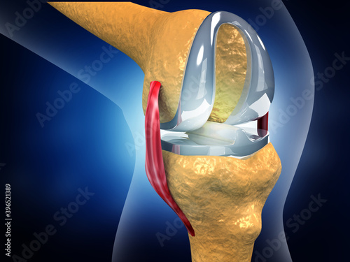 Human knee replacement implant. 3d illustration. photo
