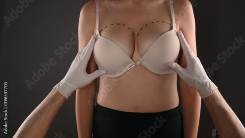 The doctor examines the breasts before cosmetic surgery