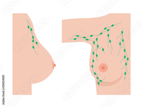 Breast disease concept