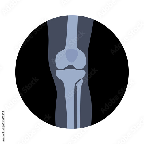 Normal bones concept