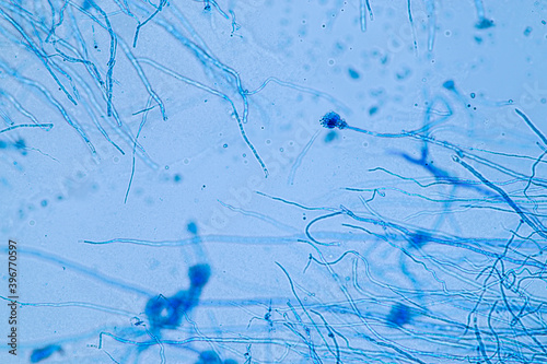 Penicillium, ascomycetous fungi are of major importance in the natural environment as well as food and drug production.  