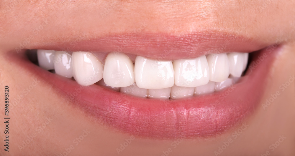 Fototapeta premium Perfect healthy teeth beautiful wide smile bleaching ceramic crowns whitening of young smiling attractive sexy lips woman. Dental zircon implants restoration treatment Close Up surgery dentistry 