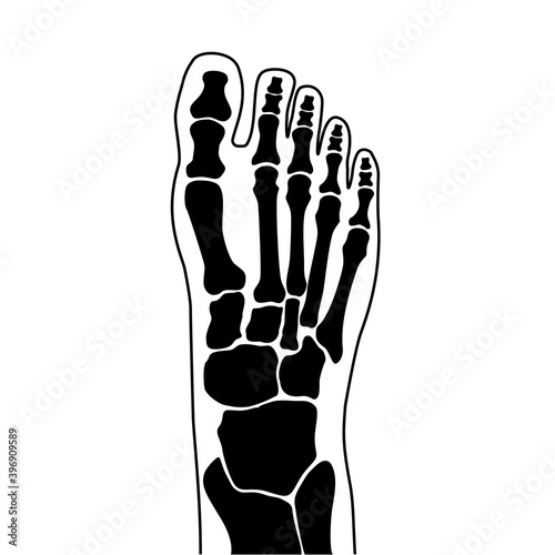 Normal bones concept