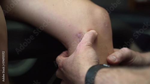 Doctor looking at athletes knee after a surgery