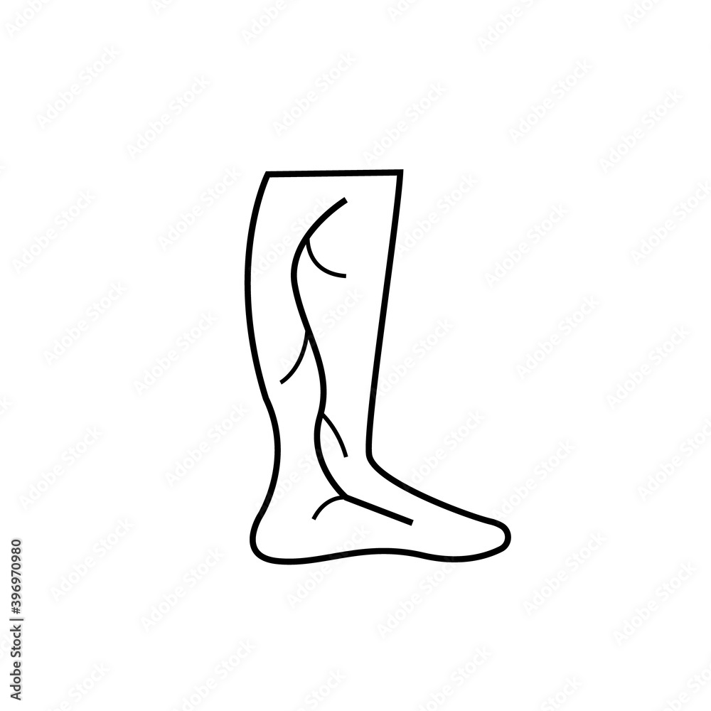 Varicose veins icon. Trendy flat vector Varicose veins icon. Trendy flat vector