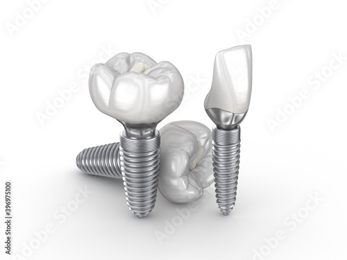Fototapeta Naklejka Na Ścianę i Meble -  Ceramic crowns, custom implant abutment and implantats. Medically accurate 3D illustration of dental implantation