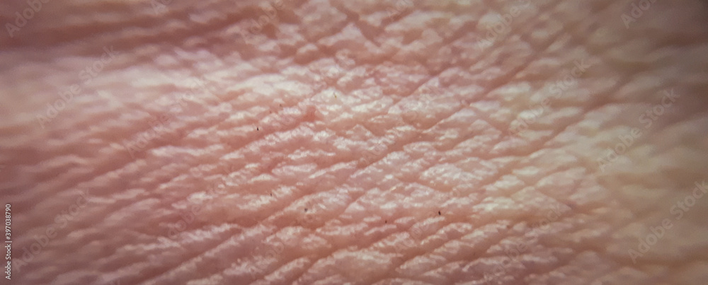 Macro of human skin texture. Dermatology pattern of healthy brown caucasian skin. Close up detail of skin for background Macro of human skin texture. Dermatology pattern of healthy brown caucasian skin. Close up detail of skin for background
