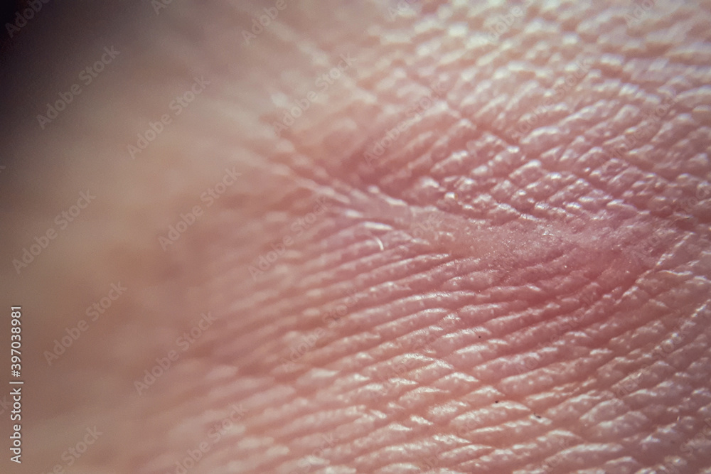Macro of human skin texture. Dermatology pattern of healthy brown caucasian skin. Close up detail of skin for background Macro of human skin texture. Dermatology pattern of healthy brown caucasian skin. Close up detail of skin for background