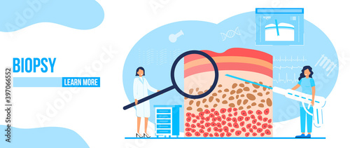 Biopsy of patient concept vector. Oncologist concept vector for app, web, blog. Tiny doctors of oncology treat patient