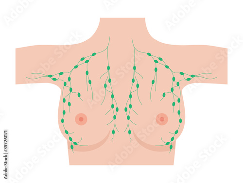 Breast disease concept