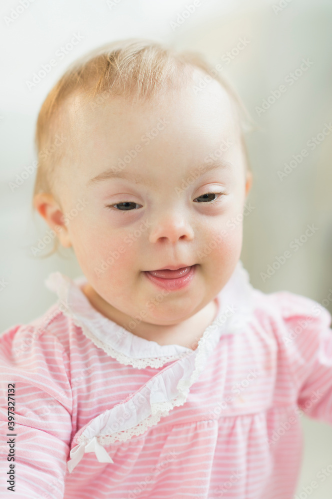 Caucasian baby girl with Down Syndrome Caucasian baby girl with Down Syndrome